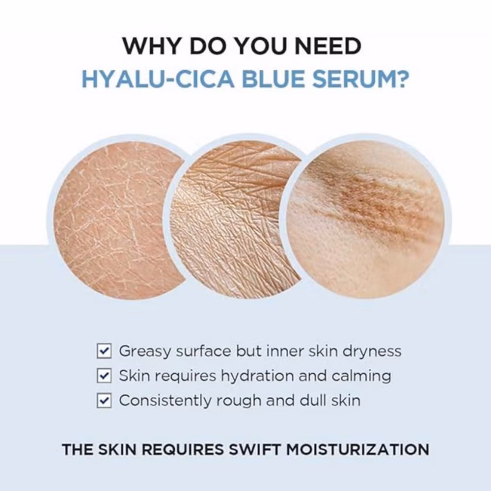 SKIN1004 Madagascar Centella Hyalu‑Cica Blue Serum 30 ml 3