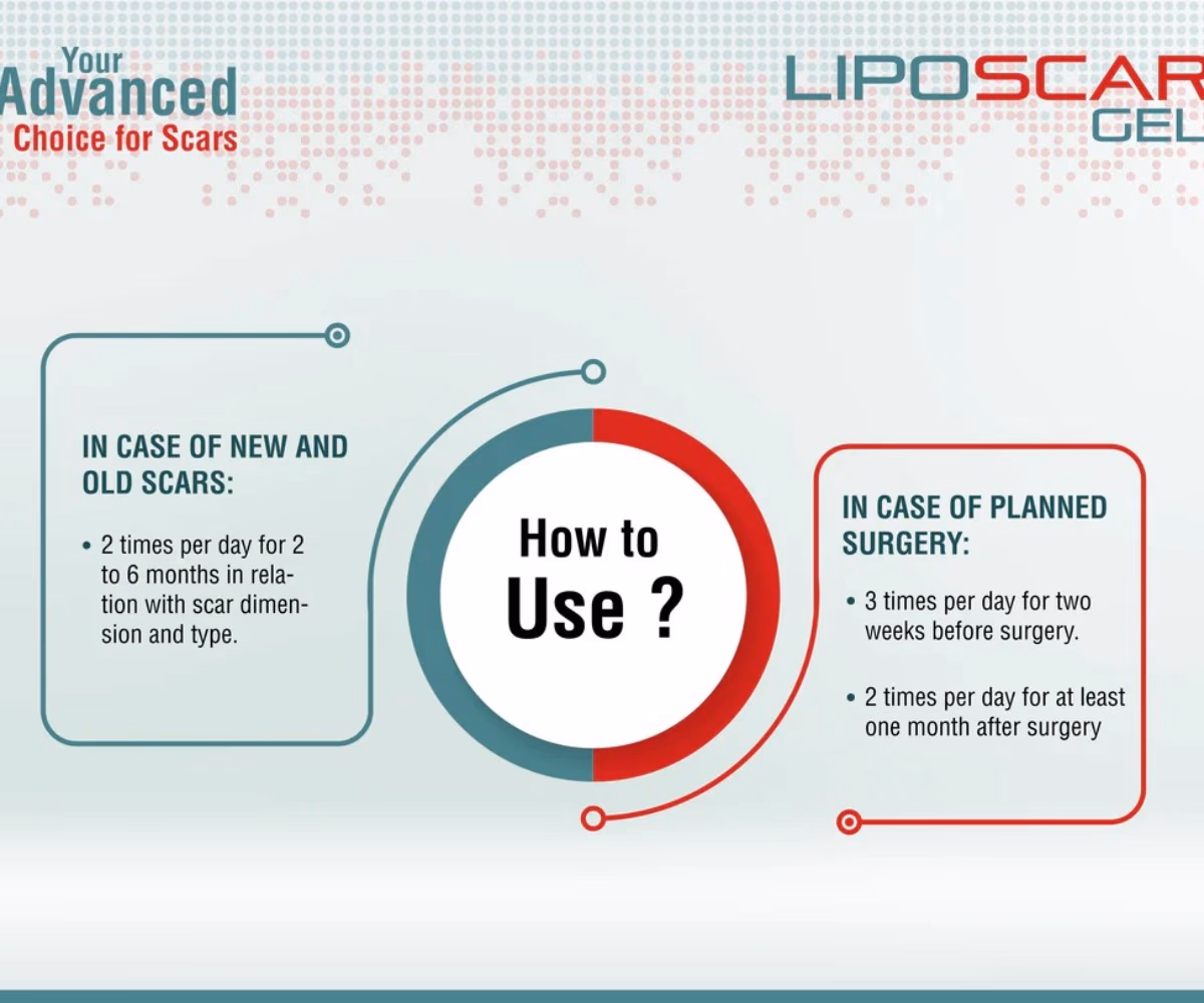 Liposcar Gel 15ml Prevention and Treatment of Scars and Strecthmarks 3