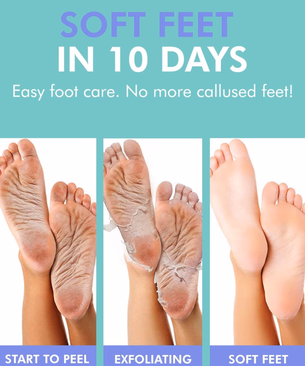 Dermal Foot Peeling Mask 1 Pair 2