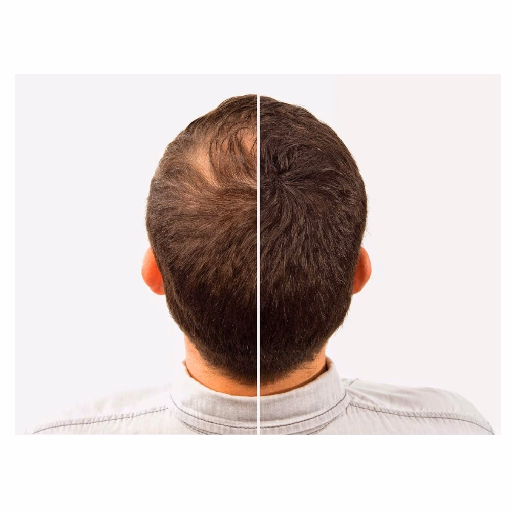 NITRO Hair Building Fibers Dark Brown 22g  3