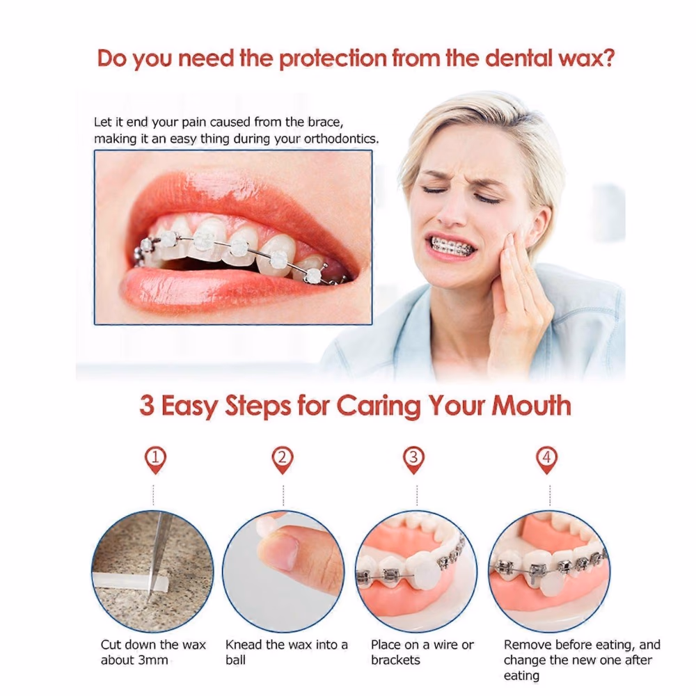 Kin Orthodontic Wax Standard for Braces and Aligners 2