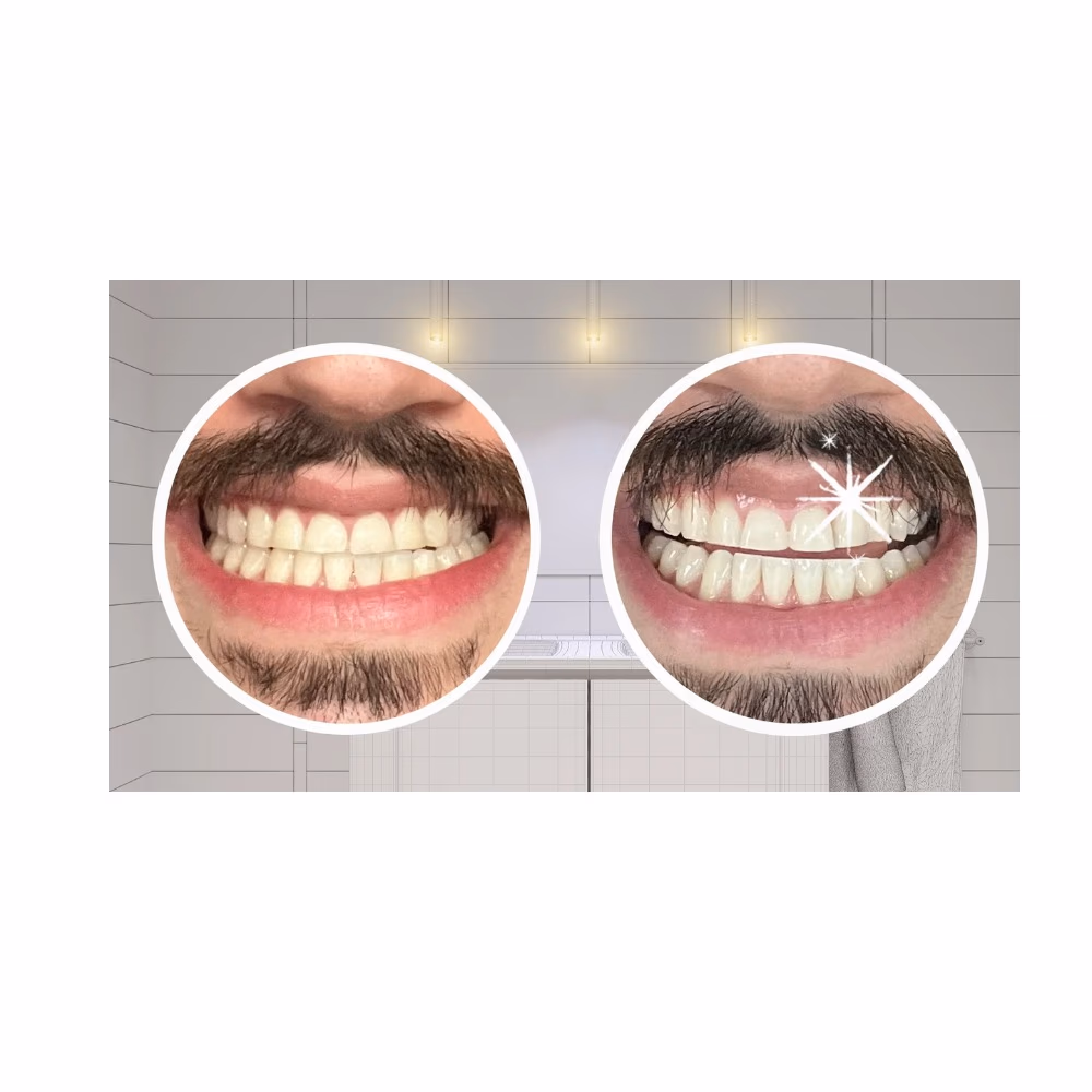 Crest 3D Whitestrips Monthly Brightener 20 Strips 2