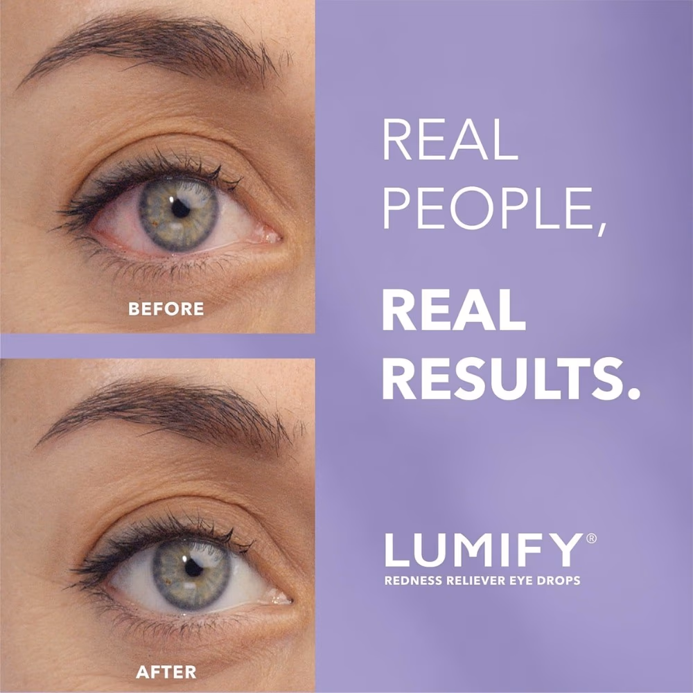 Lumify 0.025% Eye Drops 7.5ml 4