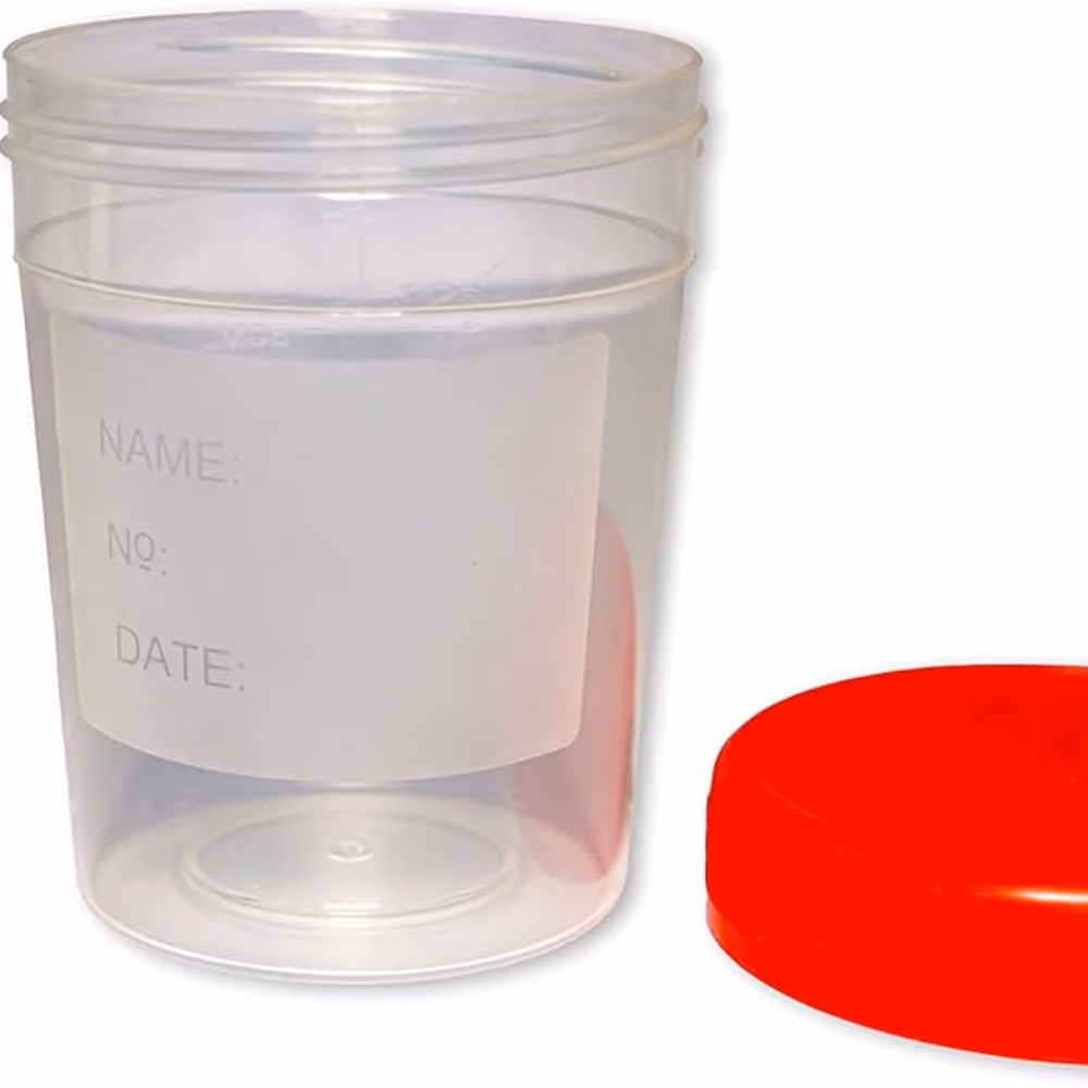 Urine Container 60ml 2