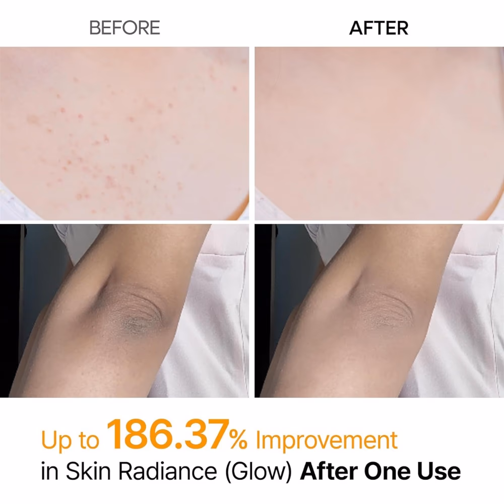 Dr. Melaxin Peel Shot Kojic Turmeric Spray 200ml 3
