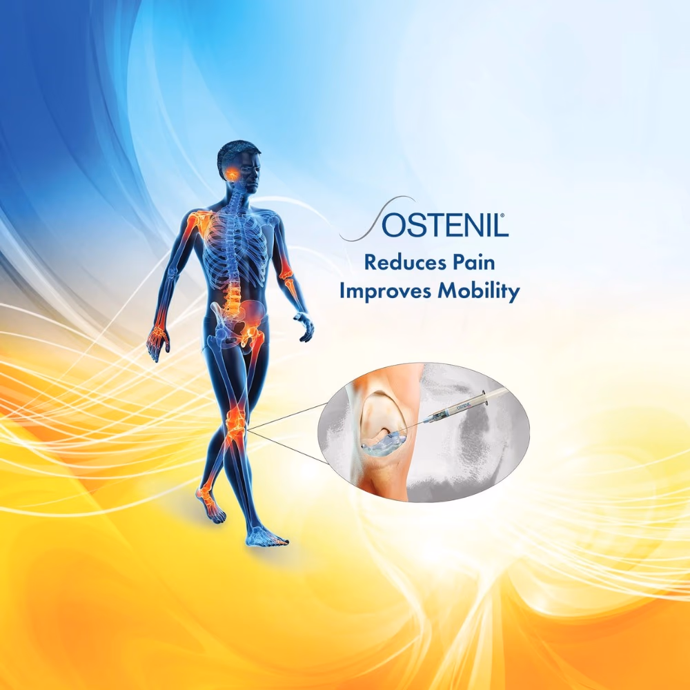 Ostenil 1% Hyaluronic Acid Injection 20mg/2ml 2