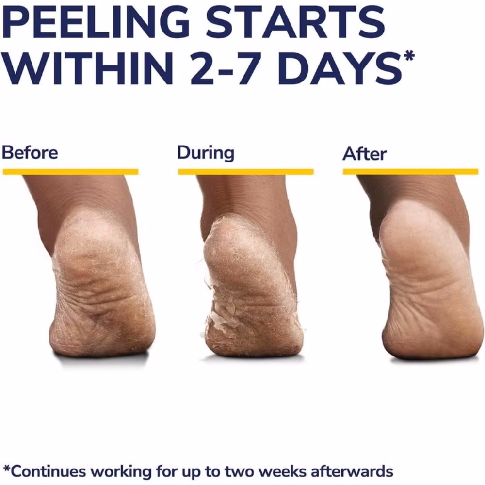 Dr. Scholl's Rough Dry Ultra Exfoliating Foot Mask 44grams 2