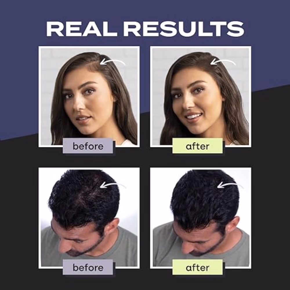 Toppik Hair Building Fibers - DarkBrown 12g 2