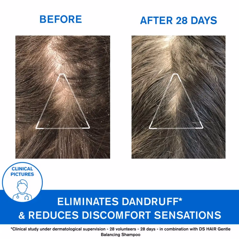 Uriage DS Hair Anti-Dandruff Shampoo 200ml 5