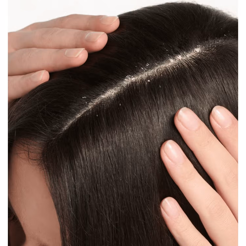 Ducray Squanorm Oily Scalp Shampoo 200ml 3
