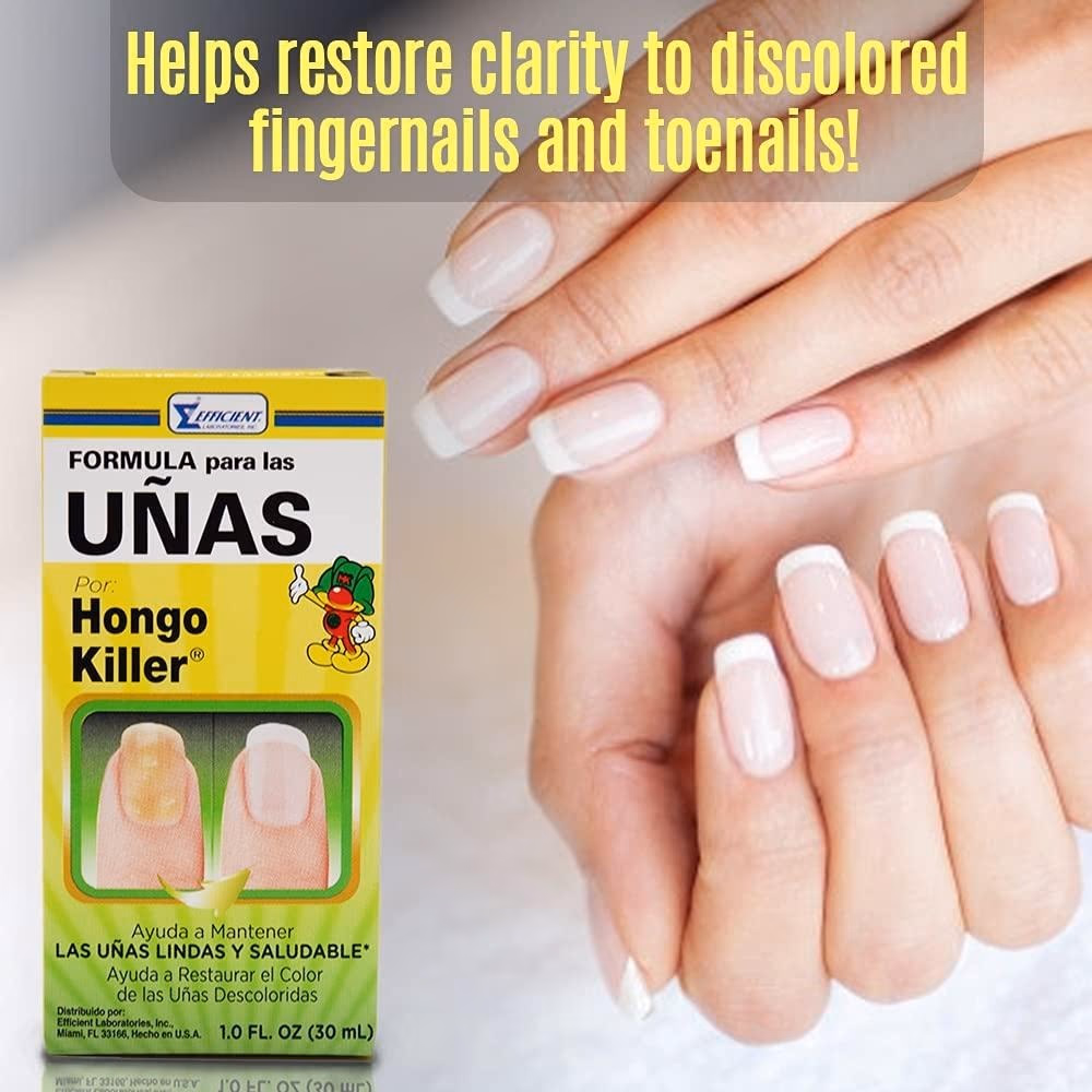 Hongo Killer Nail Formula 30ml 5