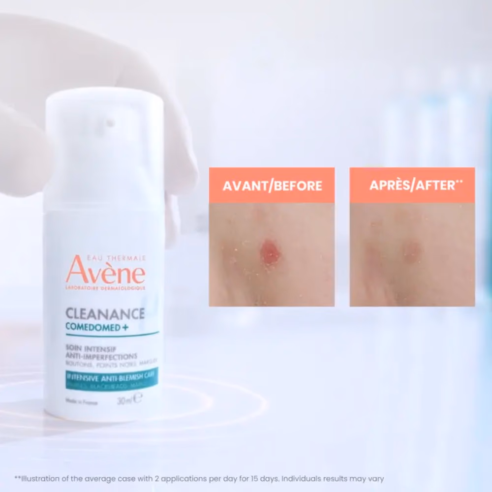 Avene Cleanance Comedomed+ 30ml 4