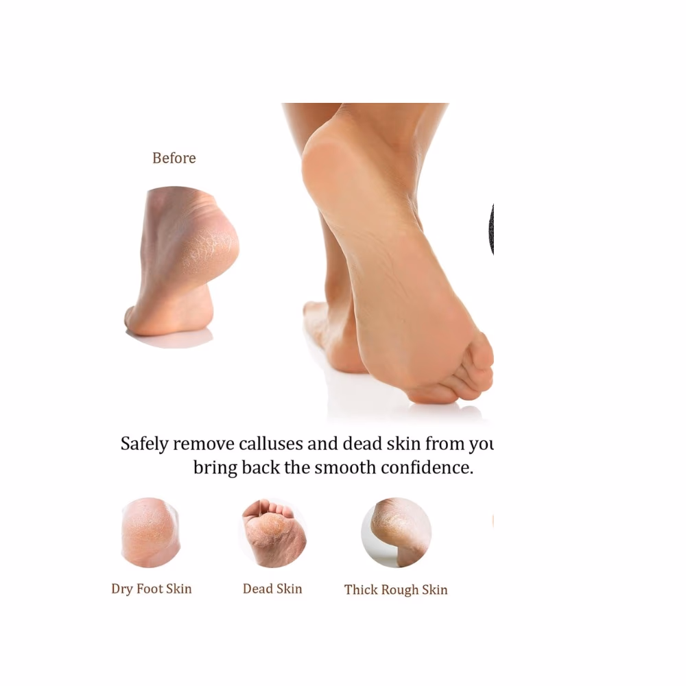 Brittny BR1685 Ceramic Callous Stone 2