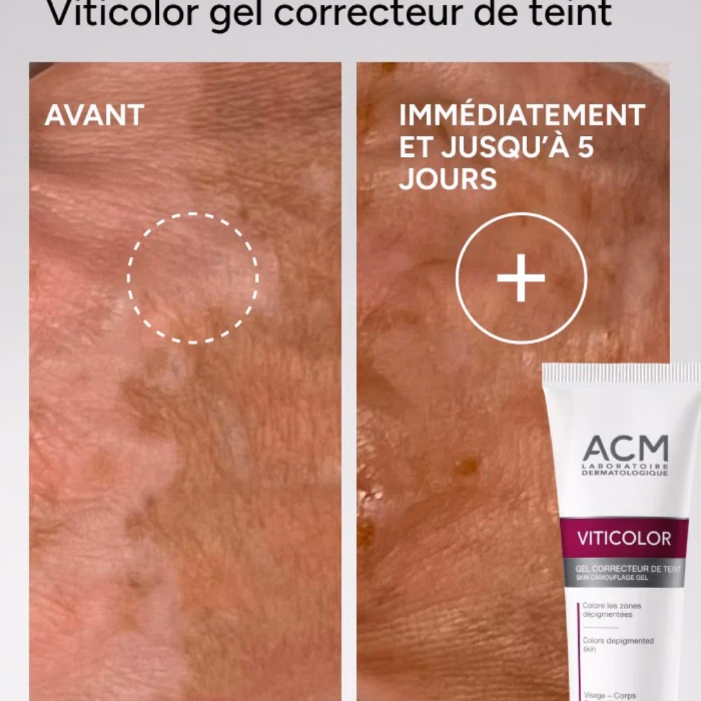 VITICOLOR Gel 50ML 3