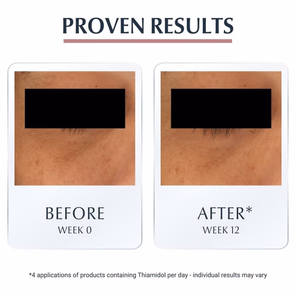 Eucerin Anti-Pigment Dark Circle Eye Corrector – 15ml  5