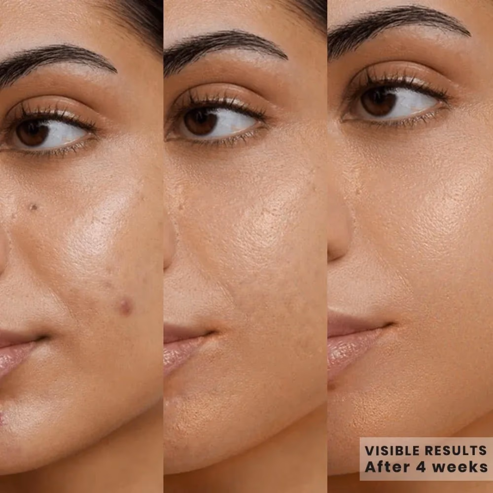 Kojic Acid Skin Lightening Face Wash Classic 125ml 2