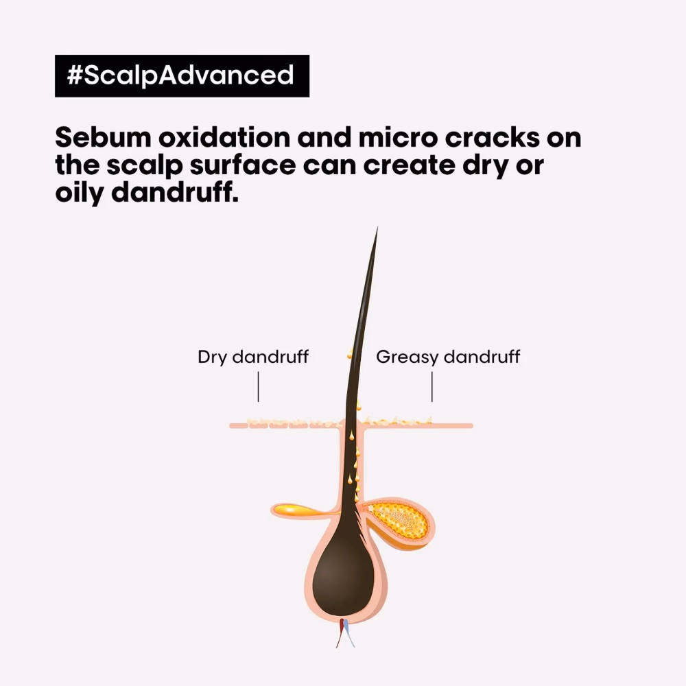 L'Oréal Serie Expert Scalp Advanced Dandruff Shampoo - 300ml 4