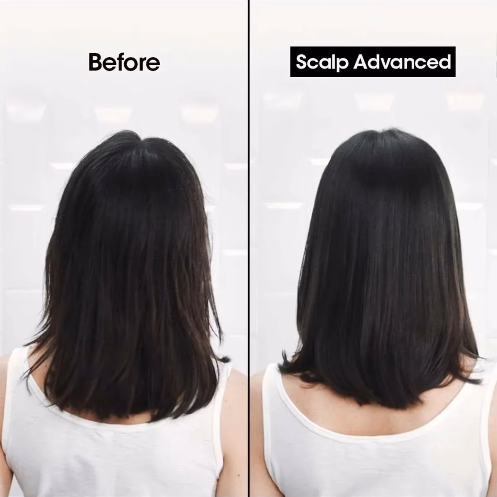 L'Oréal Serie Expert Scalp Advanced Dandruff Shampoo - 300ml 3