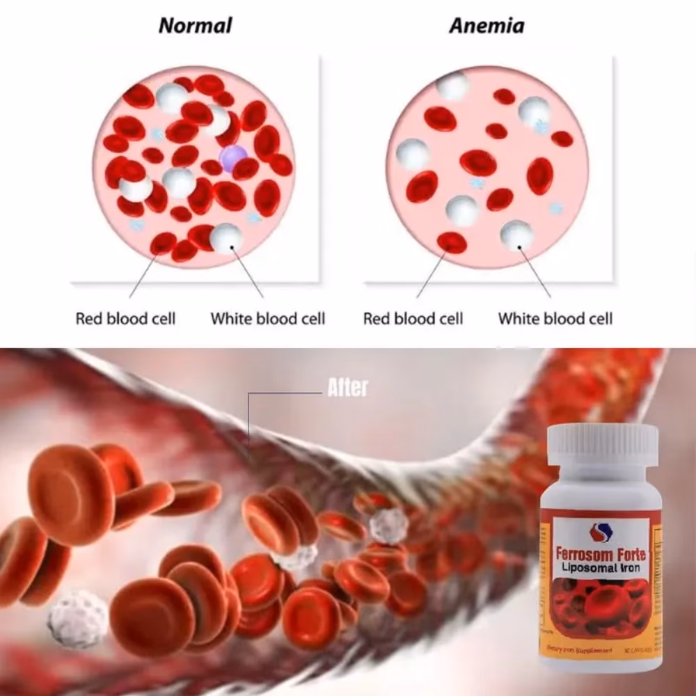 Ferrosom Forte Liposomal Iron Capsules - 30s 5