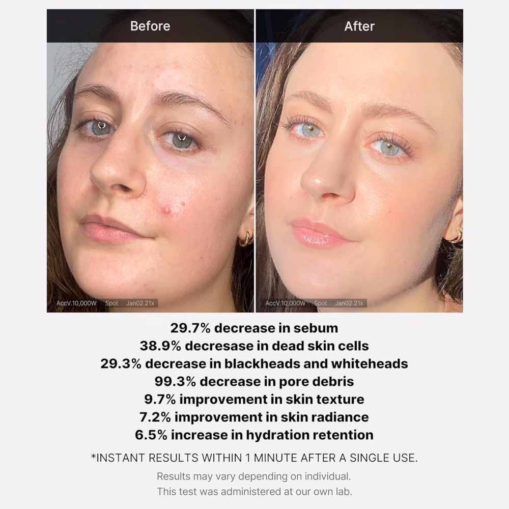 Medicube Red Succinic Acid Serum 30ml 2