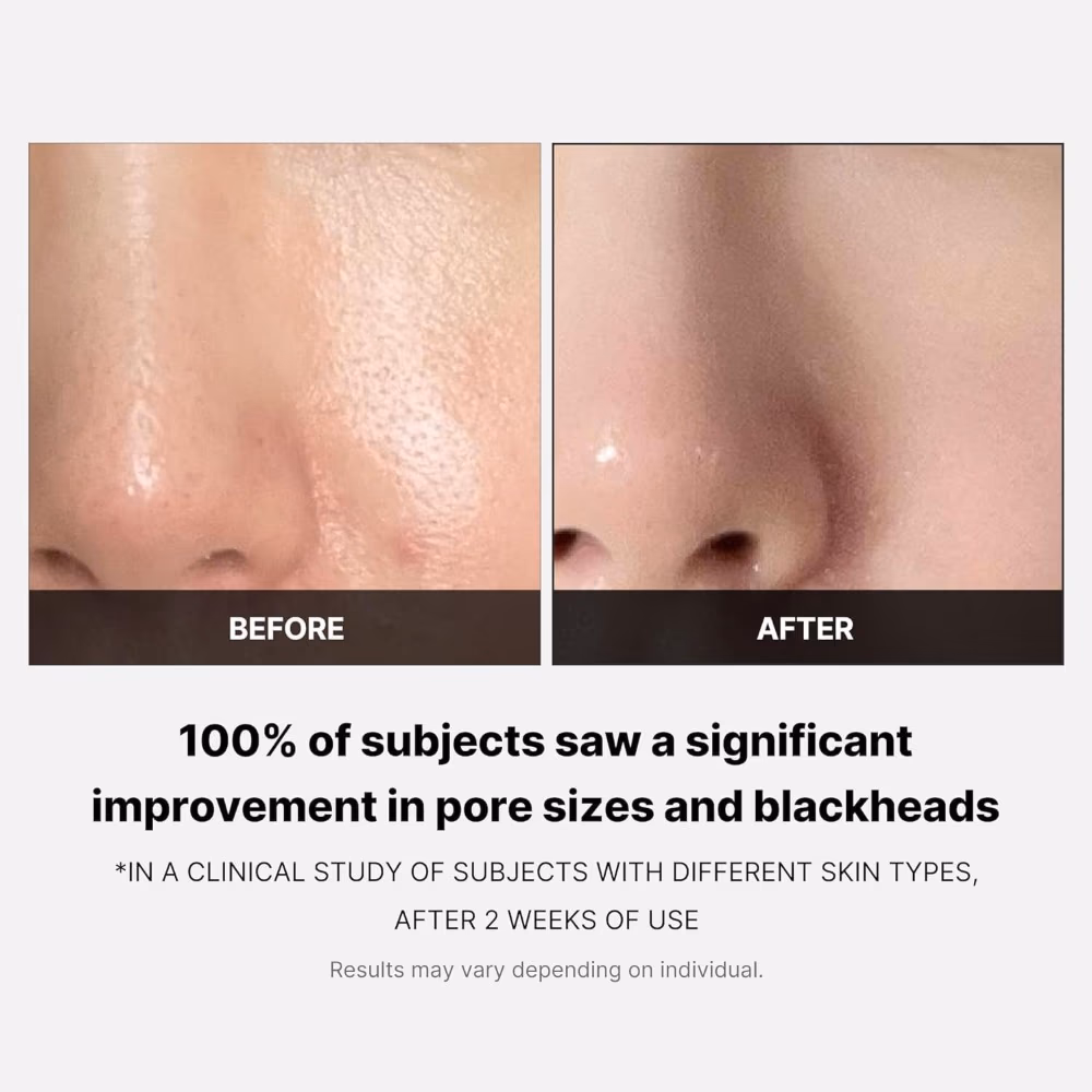 Medicube Zero Pore Blackhead Pad 70s 5