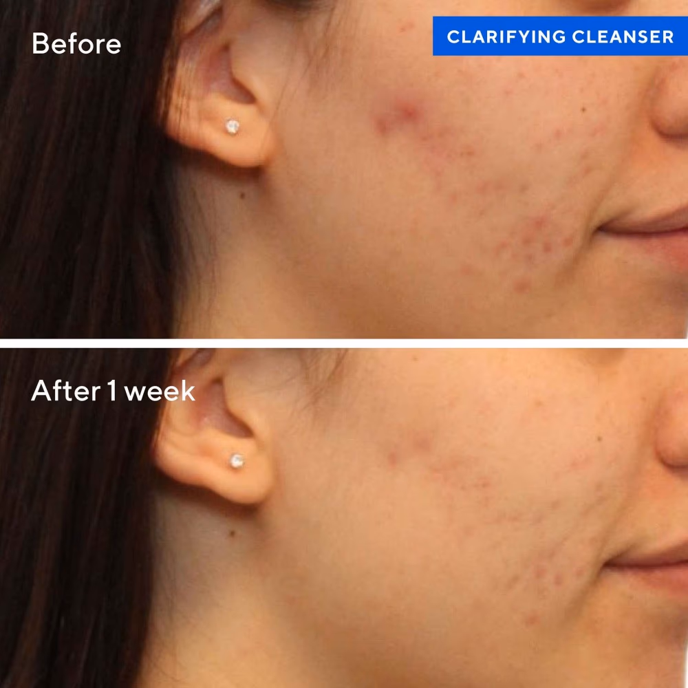 Murad Clarifying Cleanser 200ml 4