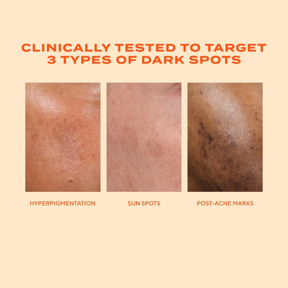 Murad Rapid Dark Spot Correcting Serum 30ml 5