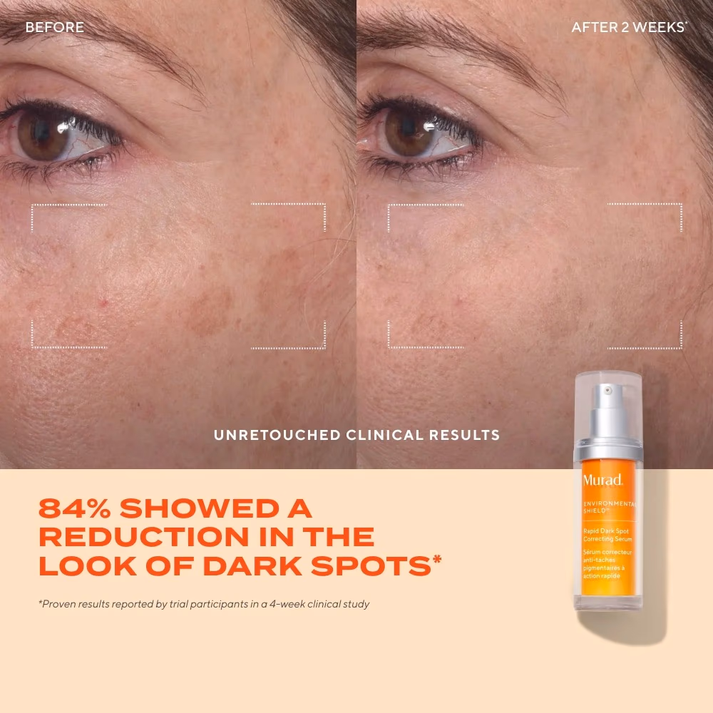 Murad Rapid Dark Spot Correcting Serum 30ml 2