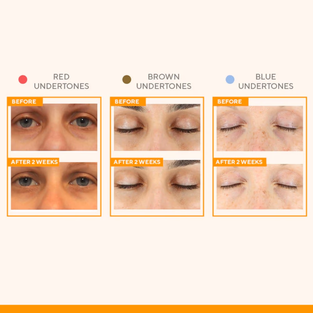 Murad Vita-C Eyes Dark Circle Corrector 15ml 3