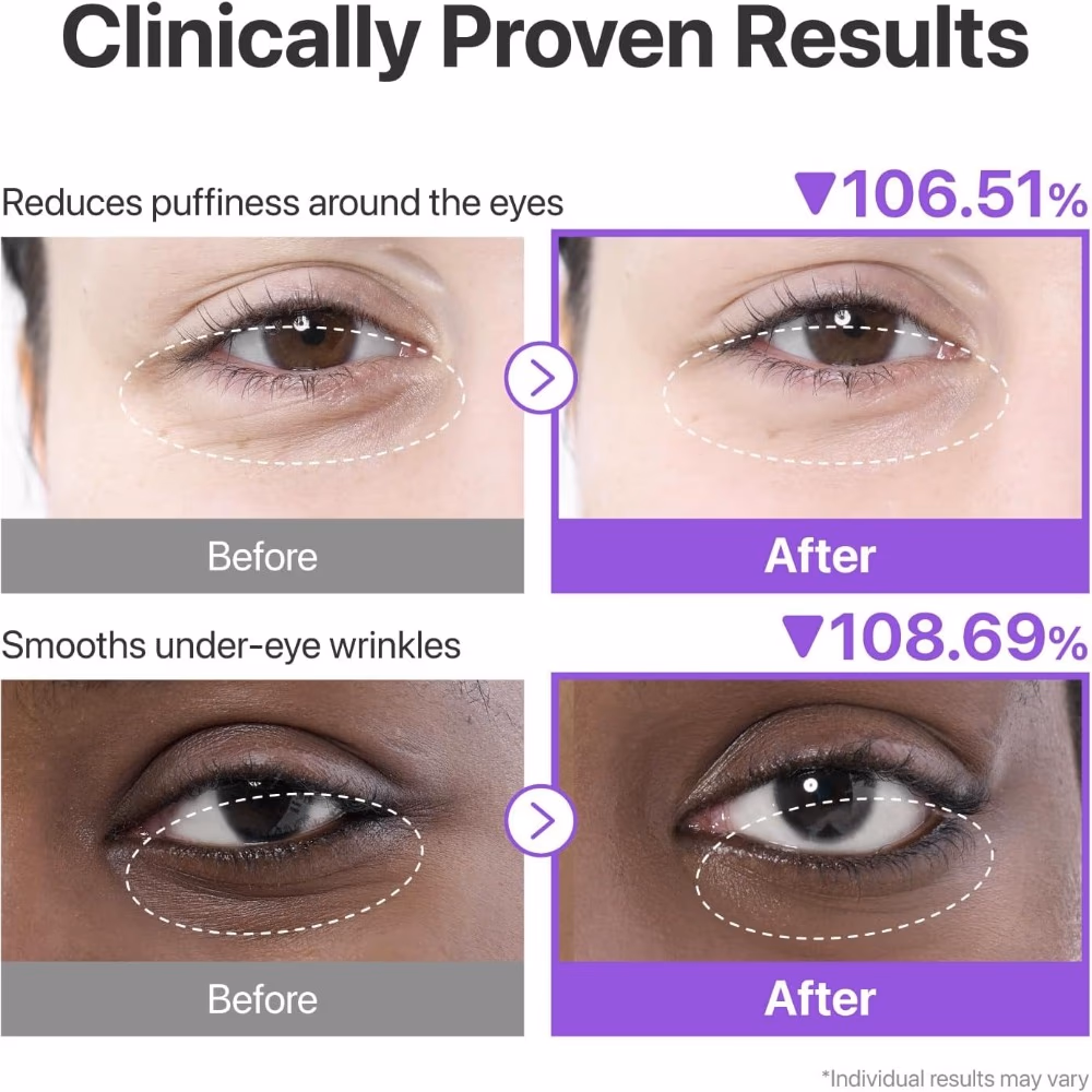 Numbuzin No. 9 NAD+ Collagen Under Eye (5 Patches) 4