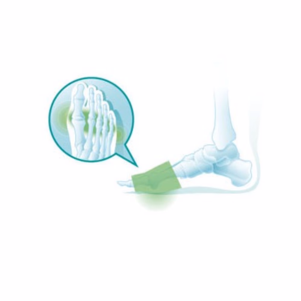 Oppo Metatarsal Foot Pads Gel 6782 Small/Medium 2