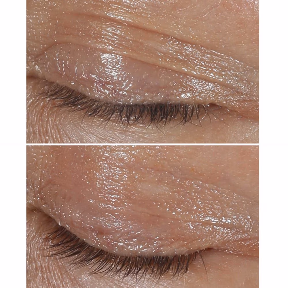 Clinique Smart Clinical Repair Eye Cream 15ml – Wrinkle Correcting Eye Cream for Smooth & Firm Skin 3