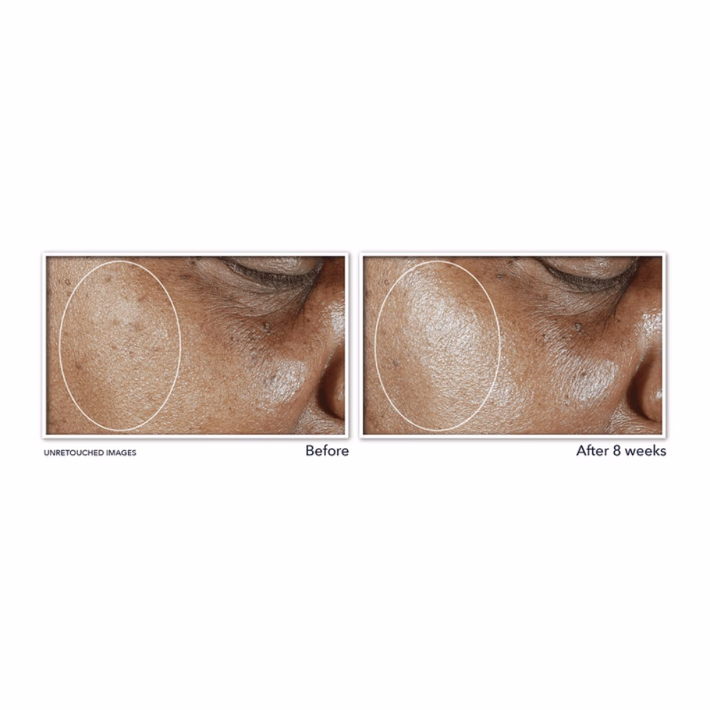 Roc Multi Correxion EvenTone + Lift Moisturizer SPF30 - 50ml 2