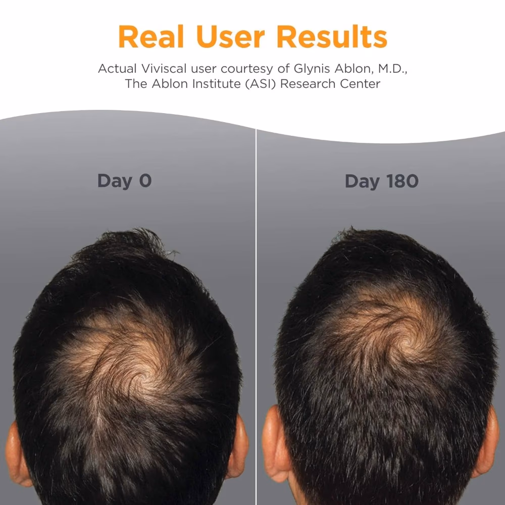 Viviscal Man Hair Growth Supplement 180 Tablets 3