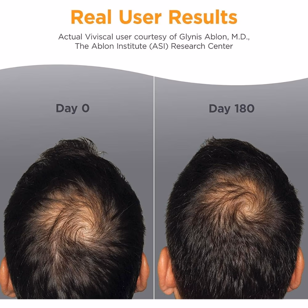Viviscal Man Hair Growth Supplement 60 Tabs 2
