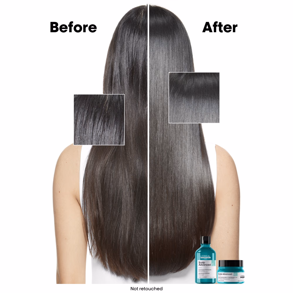 L'Oréal Professionnel Serie Expert Scalp Advanced Anti-Oiliness Shampoo 300ml 3