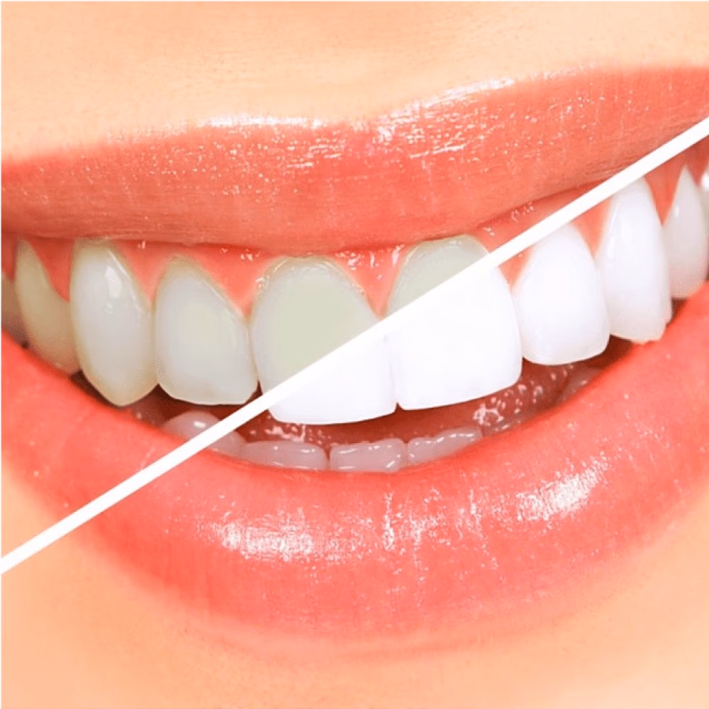 Lacalut White Toothpaste 75ml 4