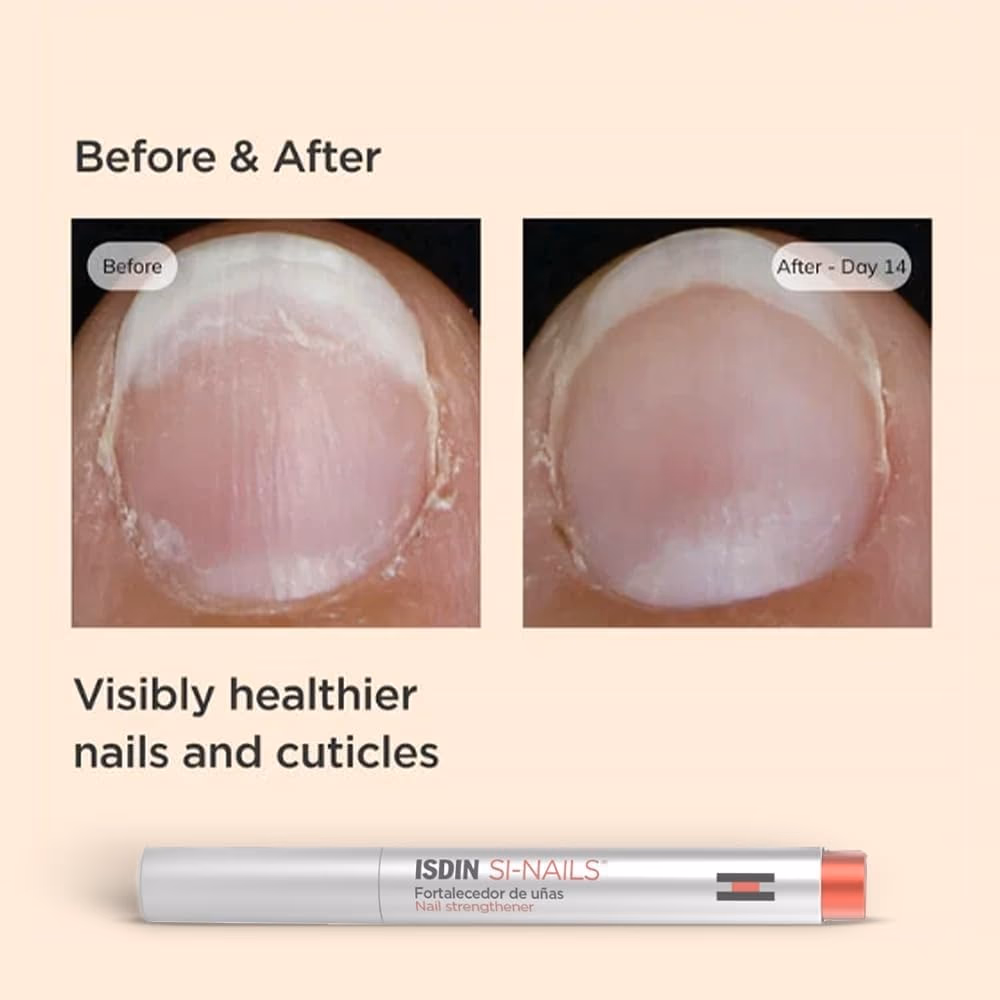 ISDIN Si-Nails Nail Strengthener 2.5ml  5