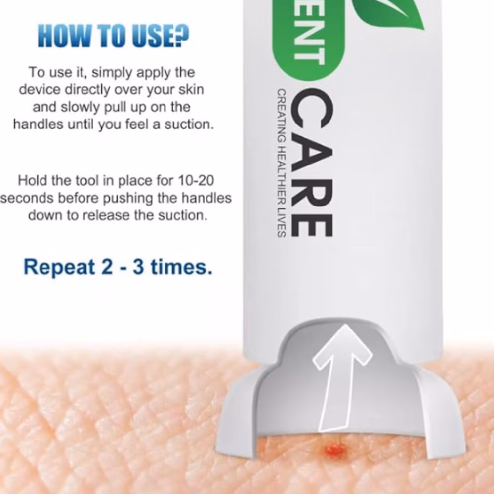 After Bite Classic Handy Pen 14ml 2