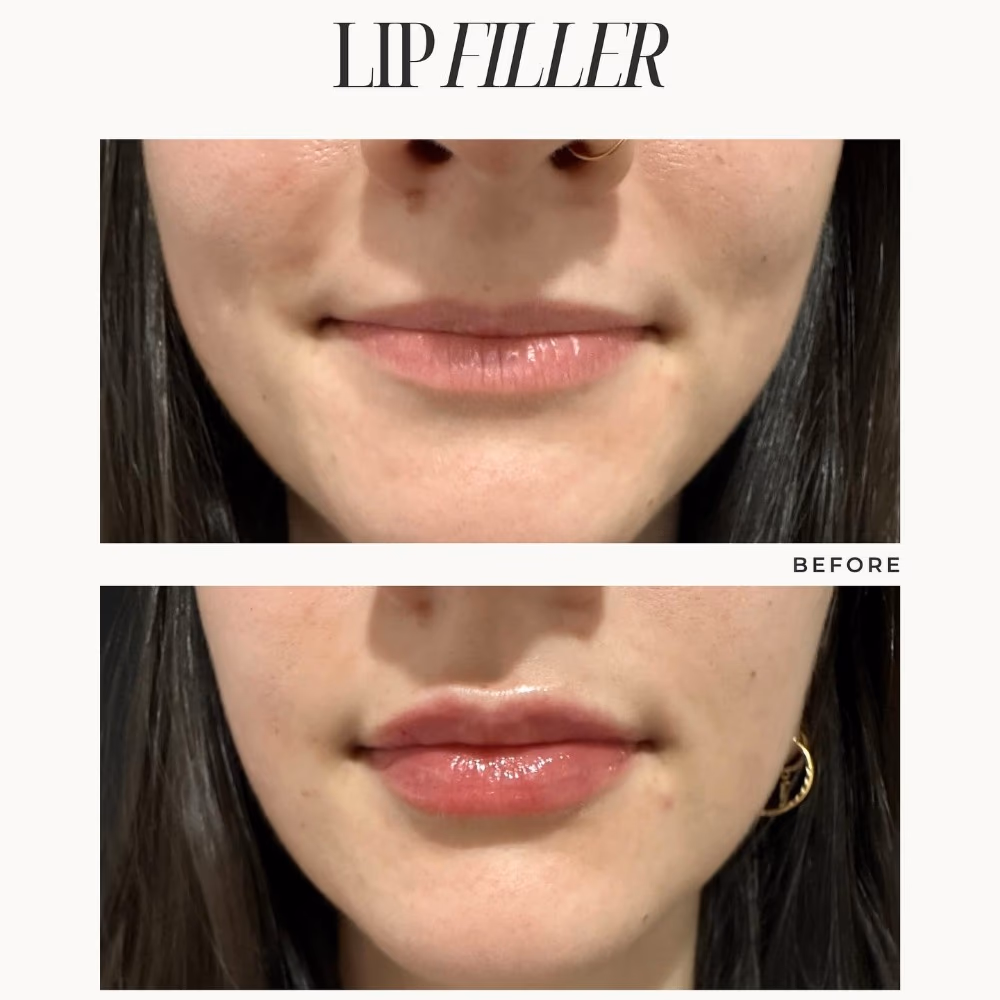 Filorga Nutri Filler Lips 4gm 4
