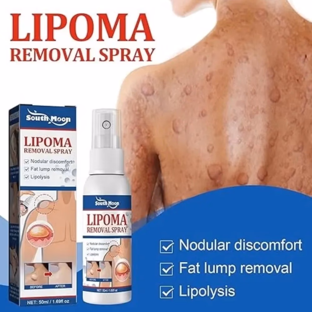 South Moon Lipoma Removal Spray 50ml 2