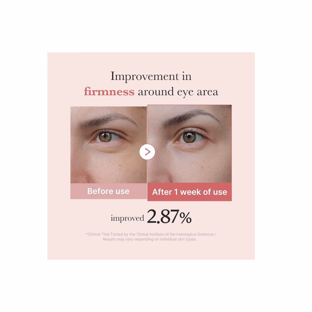 Medicube Pdrn Pink Peptide Eye Cream 30ml 5