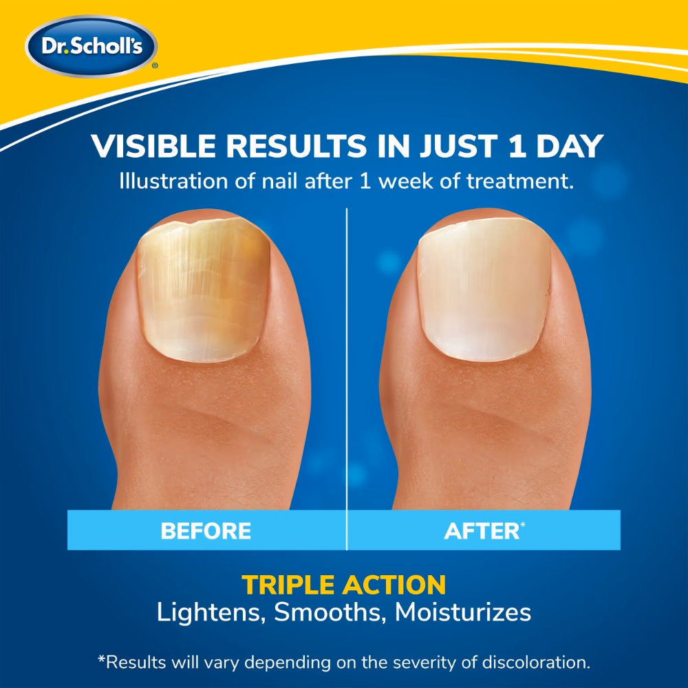 Dr. Scholl's Fungal Nail Light Therapy Revitalizer 4
