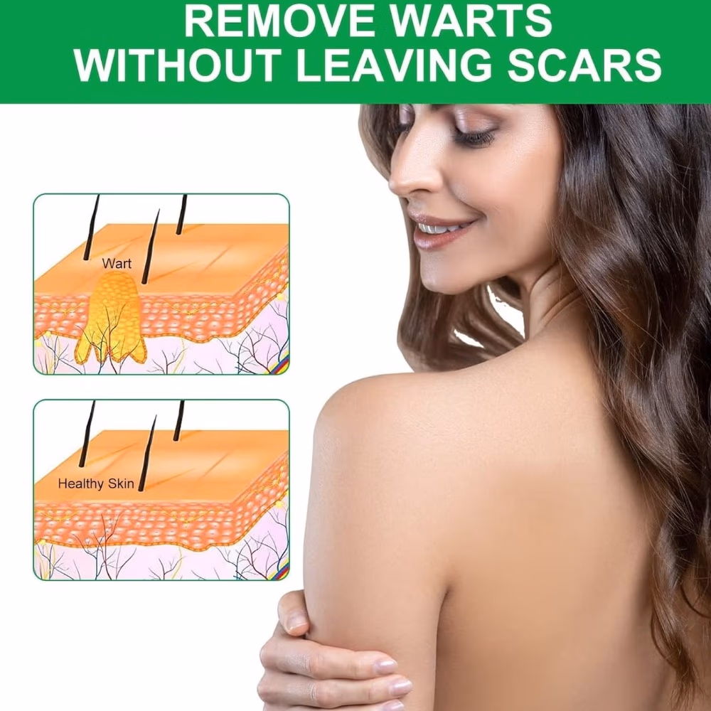 G-Warts 5% Cream Sachets (12's) 3