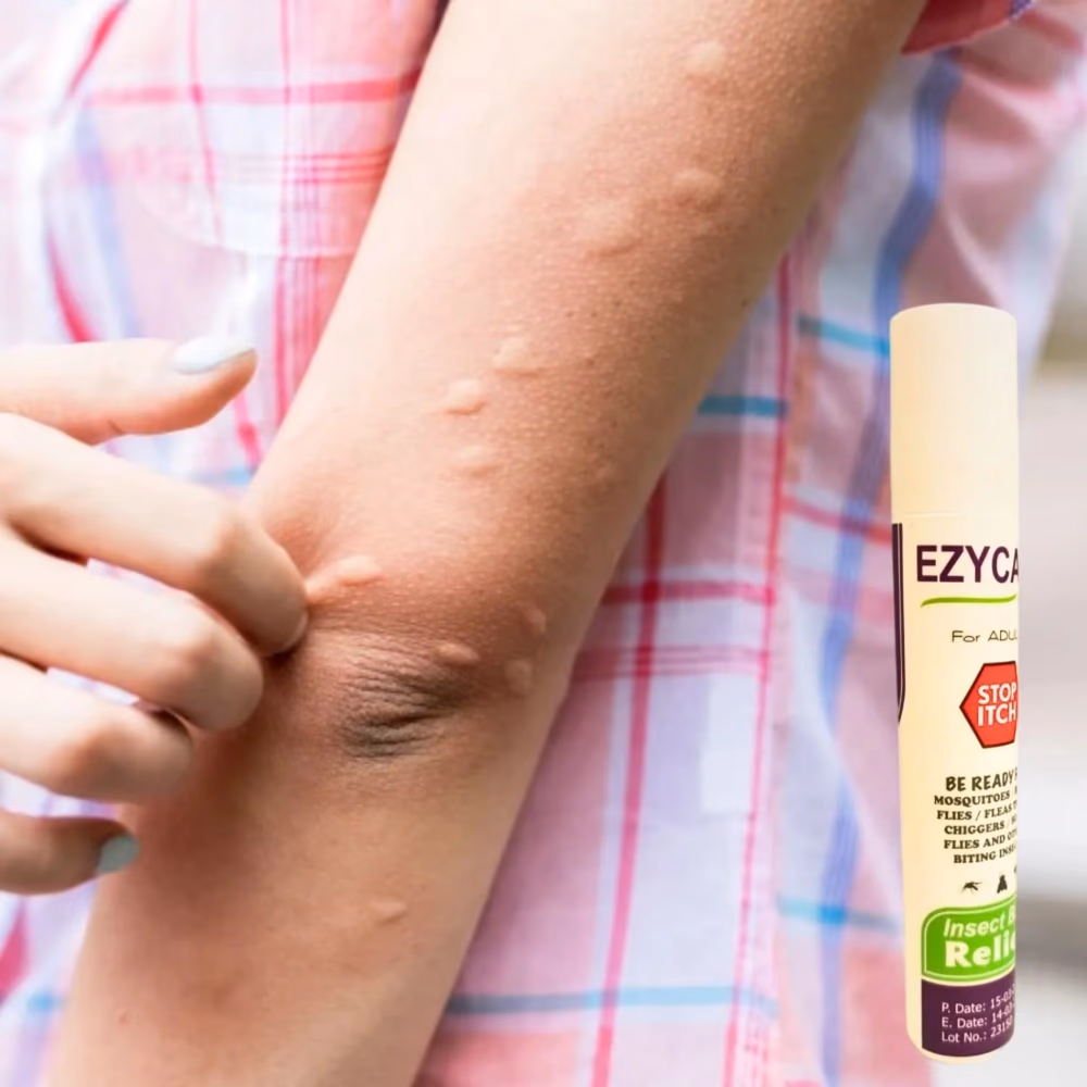 EzyCare Insect Bite Relief for Kids 15ml 2