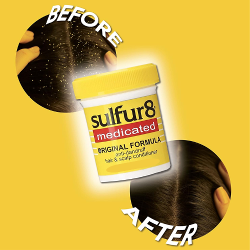Sulfur8 Original Formula Anti Dandruff Hair Scalp Conditioner 205g 4