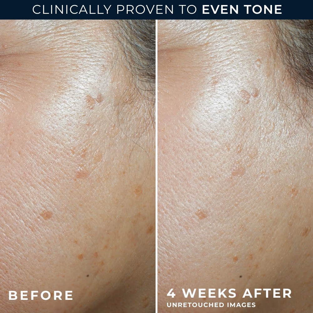 RoC Even Tone Lift Daily Moisturizer SPF 30 (50ml) 3
